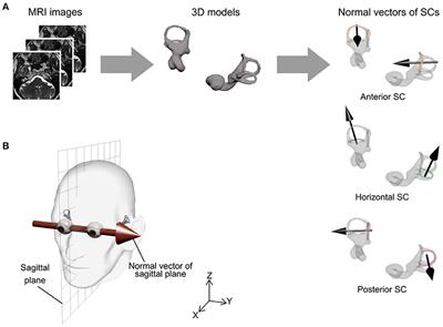Vestibular Morphological Asymmetry Associated With Motion Sickness Susceptibility